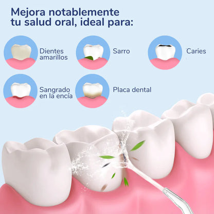 Irrigador OralFlow® | Dientes Blancos & Higiene Profunda + Accesorios Grátis - 50% DE DESCUENTO