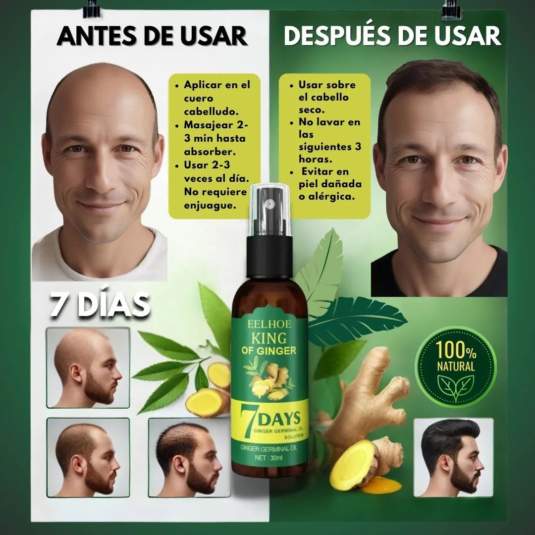 Tónico Crecimiento de Cabello - PAGA AL RECIBIR
