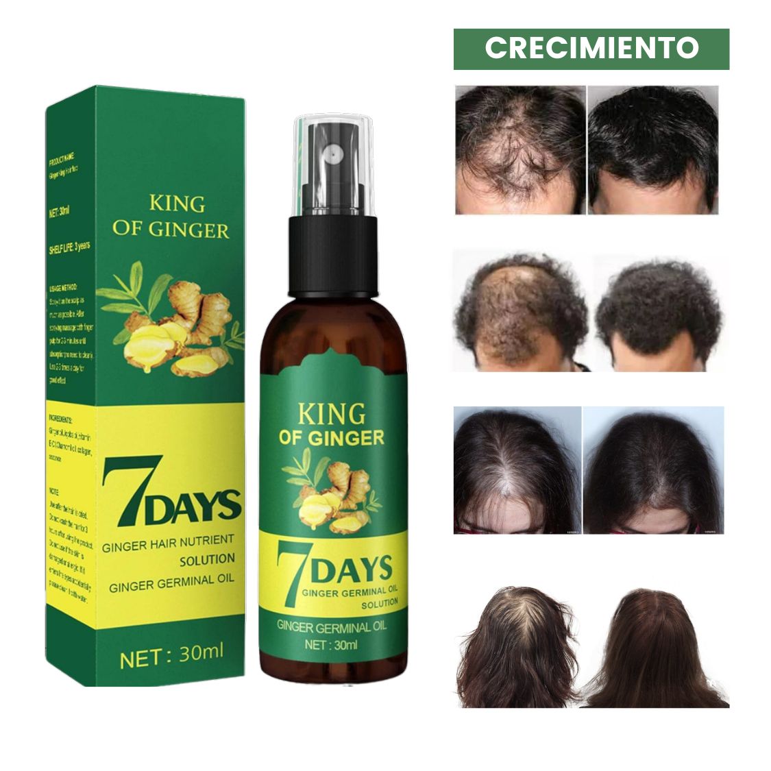 Tónico Crecimiento de Cabello - PAGA AL RECIBIR