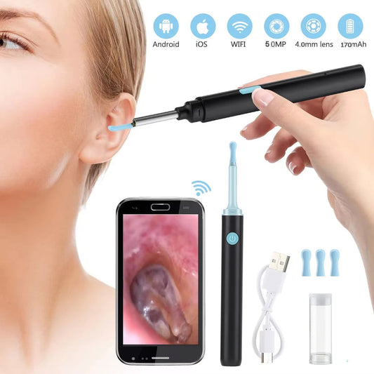 Otocam™ Limpieza de Oídos con camara Inteligente - 50% DESCUENTO HOY